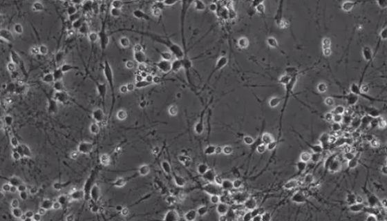 小鼠下丘脑神经元细胞复苏与冻存实验步骤！