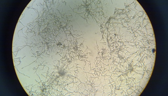 密苏里游动放线菌——用于产葡萄糖异构酶