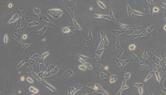N1S1大鼠肝癌细胞的培养操作步骤与处理方法！