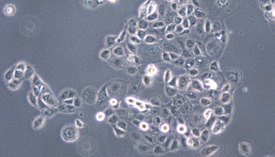 Tregs小鼠调节T细胞的处理方法与培养步骤！