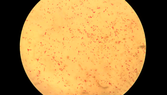 水稻黄单胞菌(水稻白叶枯菌)冻干管打管说明！