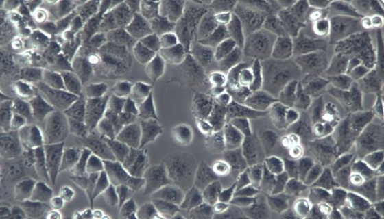 小鼠甲状腺滤泡上皮细胞的分离方法与质量检测！