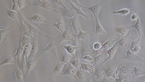 U-2OS]人骨肉瘤细胞的培养操作步骤及应用！