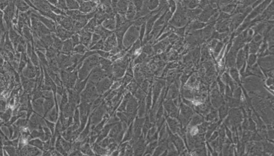 HSKMC人骨骼肌细胞接收后的处理与培养方法！