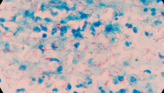 ATCC 19420耻垢分枝杆菌的特点与优势及培养！