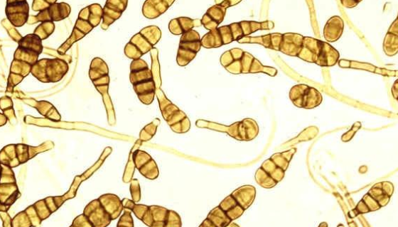 链格孢菌属的生物学特性与发生规律及主要用途！