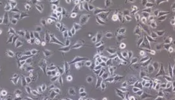 T24人膀胱移行细胞癌细胞的培养与传代及应用！