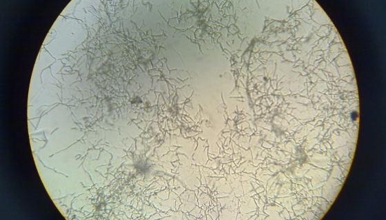 马杜拉放线菌——代谢产物具有抗真菌活性