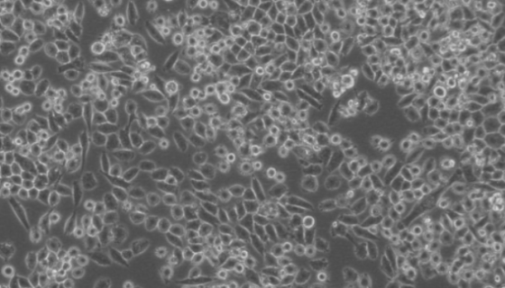 JF305人胰腺癌细胞的复苏与传代及冻存流程！