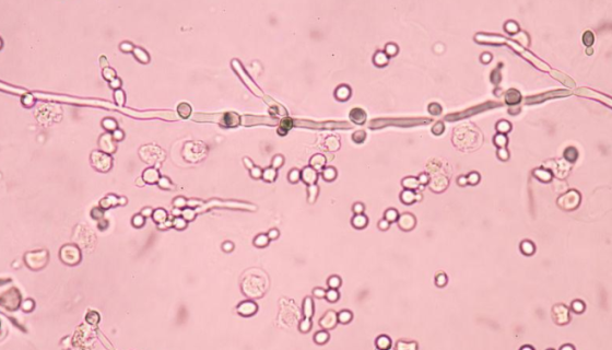 皮状丝孢酵母：利用亚硫酸废液培养饲料酵母