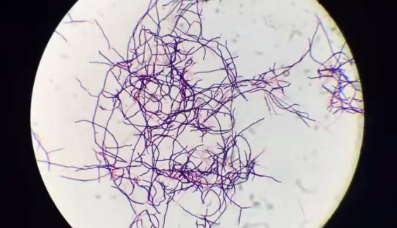 产二素链霉菌的形态特征与主要价值及恢复培养！