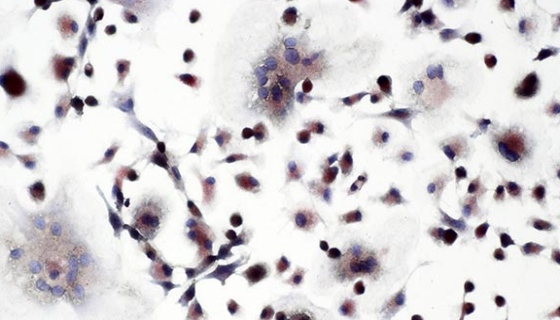 小鼠破骨细胞的培养方式与质量检测及注意事项！