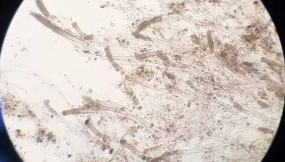 疏棉状嗜热霉——用于生产淀粉酶和白酒酿造