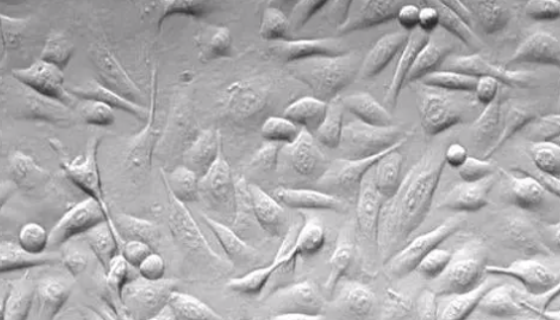 人乳腺上皮细胞的背景与应用及培养操作！