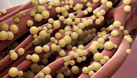 铅黄肠球菌的培养条件与注意事项及打管说明！