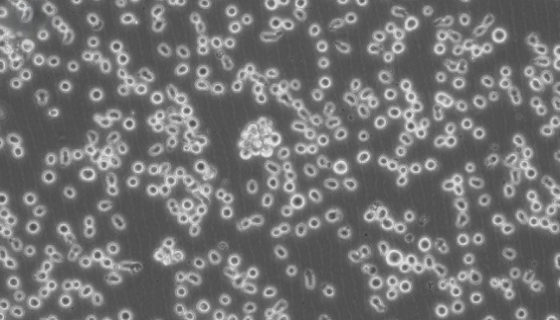 人慢性骨髓性白血病细胞系的培养操作步骤！