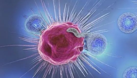 人NK细胞淋巴瘤细胞的处理方法与培养步骤！