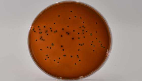 伊红美蓝琼脂培养基（Levine）的使用与实验方法！