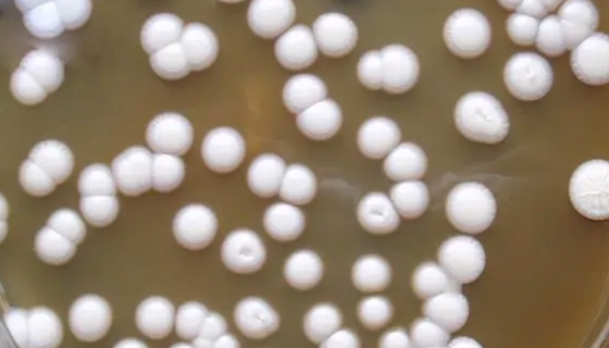 拟多形假丝酵母的保存方法与微生物菌种培养！