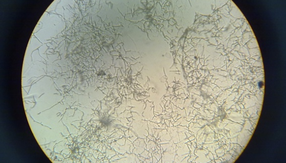 吕宋马杜拉放线菌：代谢产物具有弱的抗菌活性