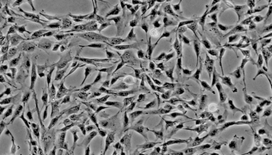 人脂肪间充质干细胞的培养操作步骤及应用！