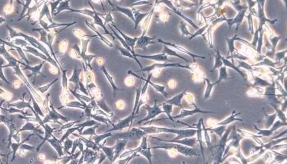 小鼠海马神经元细胞的运输和保存及使用方法！