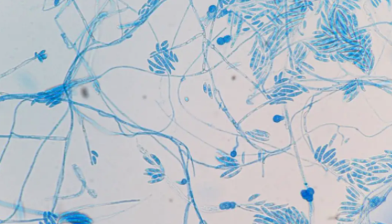 茄病镰刀菌的特点优势与主要价值及培养方法！