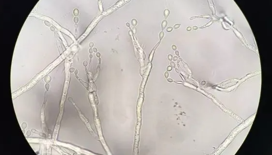 齐藤假丝酵母——生产柠檬酸及合成维生素B2