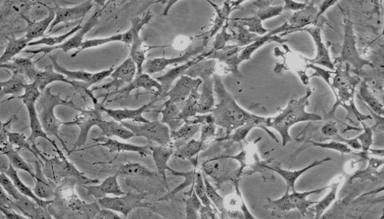 MN9D小鼠中脑多巴胺能神经元细胞的应用！