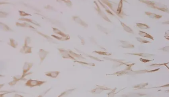 人牙周膜成纤维细胞的性质用途与生产工艺！