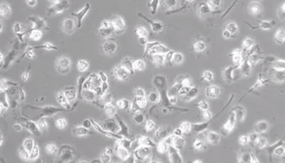 人脑胶质细胞株收到后处理方法与培养步骤！