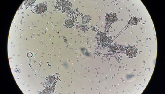 棒曲霉的形态描述与培养方法及注意事项！