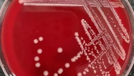 ATCC 25296 胺胨罗斯氏菌的培养及打管说明！