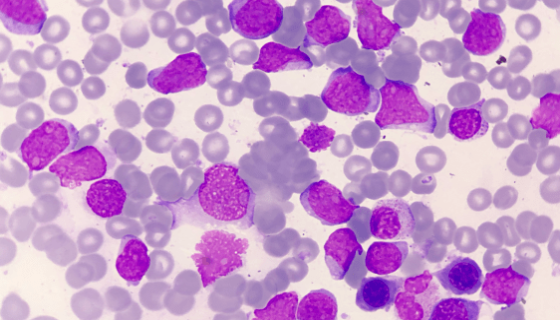 人T淋巴母细胞瘤细胞复苏与传代及冻存实验步骤！