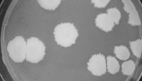 地衣形芽孢杆菌的菌株培养与注意事项及保存方法！