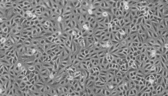 NCI-H82人小细胞肺癌细胞收货处理及培养步骤！