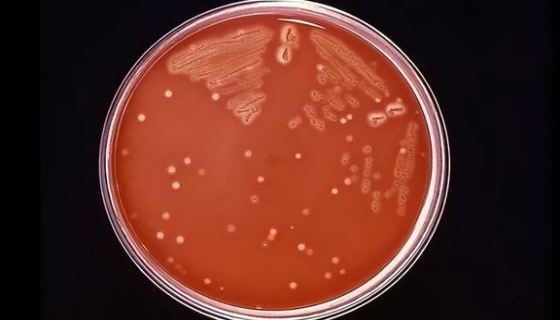 嗜肉考克氏菌的特点与优势及培养与保存！