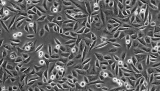 人类鳞状上皮舌癌细胞的处理方法与培养步骤！