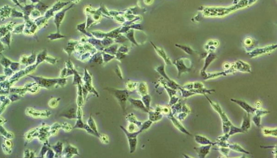 TEC人胸腺上皮细胞的培养操作规程及注意事项！