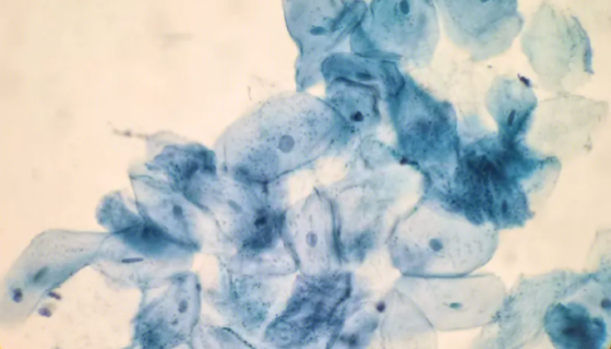 HOK人正常口腔角质细胞的培养方式与质量检测！