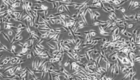 B16-OVA小鼠黑色素瘤细胞（鸡OVA基因修饰）