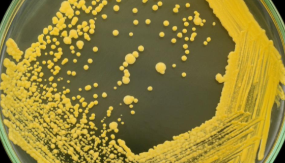 ATCC 49129 皮氏罗尔斯顿菌 百欧博伟生物