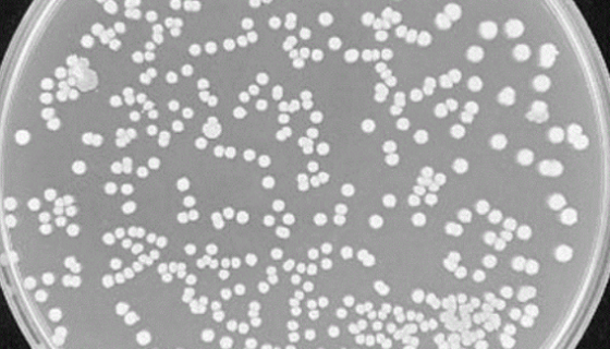 球形賴氨酸芽孢桿菌的特點(diǎn)與優(yōu)勢(shì)及菌株培養(yǎng)！