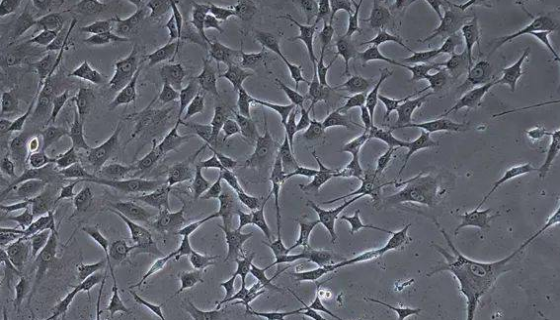 大鼠胸主动脉平滑肌细胞的处理方法与培养步骤！