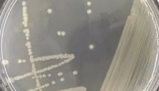 需钠弧菌的培养方法与实验内容及打管说明！