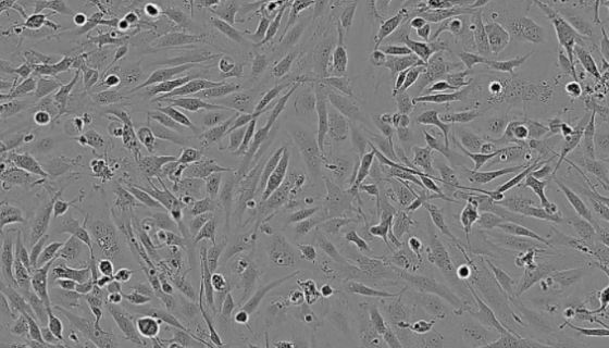 人恶性黑色素瘤细胞接收后的处理方法与培养步骤！