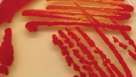 ATCC 183 普利茅斯沙雷氏菌冻干管打管说明！