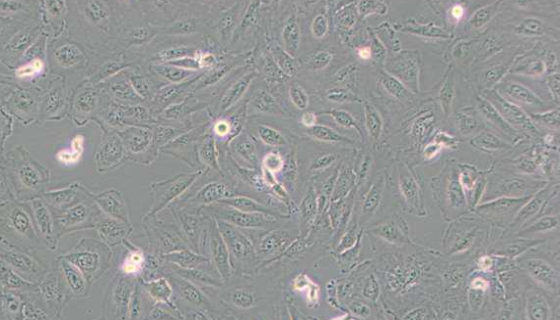 D341 Med人髓母细胞瘤细胞收到后处理及其培养！
