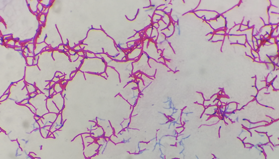 杀鲑诺卡氏菌的培养方法与注意事项及打管说明！