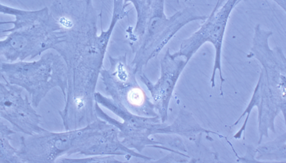 猪心肌成纤维细胞的运输和保存及使用方法！